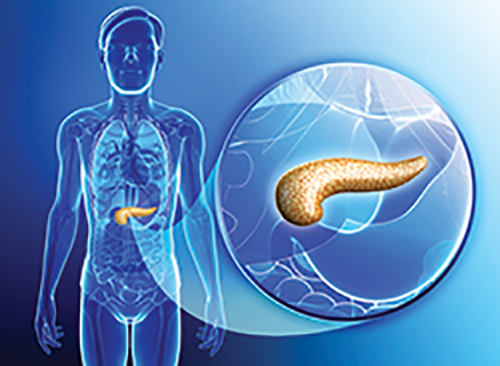 pancreas1459218218-1.jpg