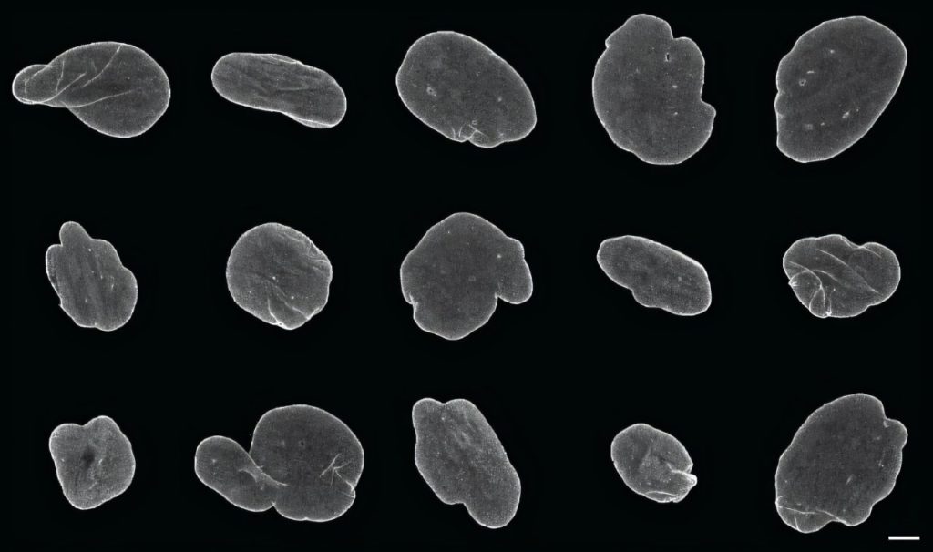 exigs-bridges-microsco.jpg