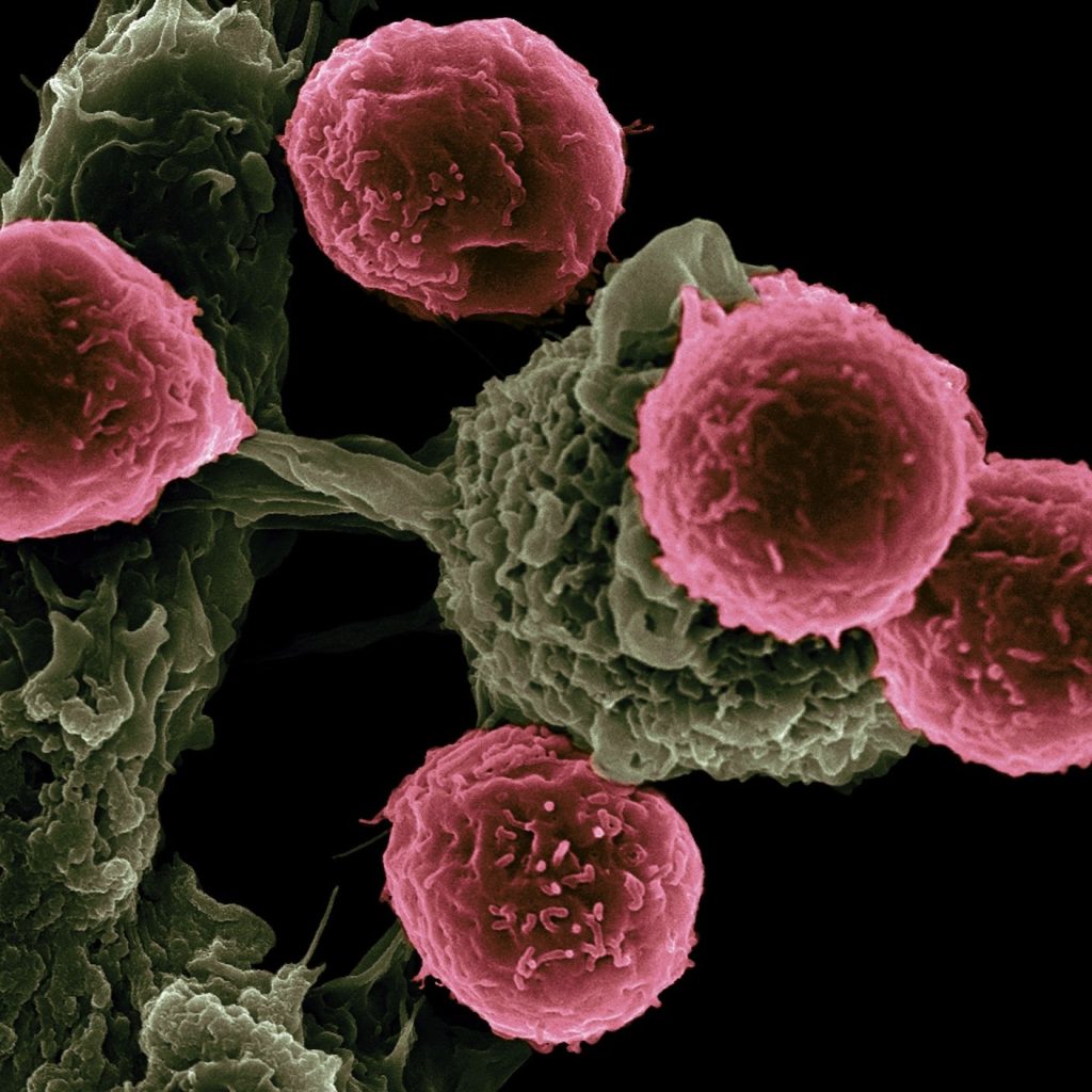 scanning-electron-microscope-t-cells-dendritic-cells.jpeg