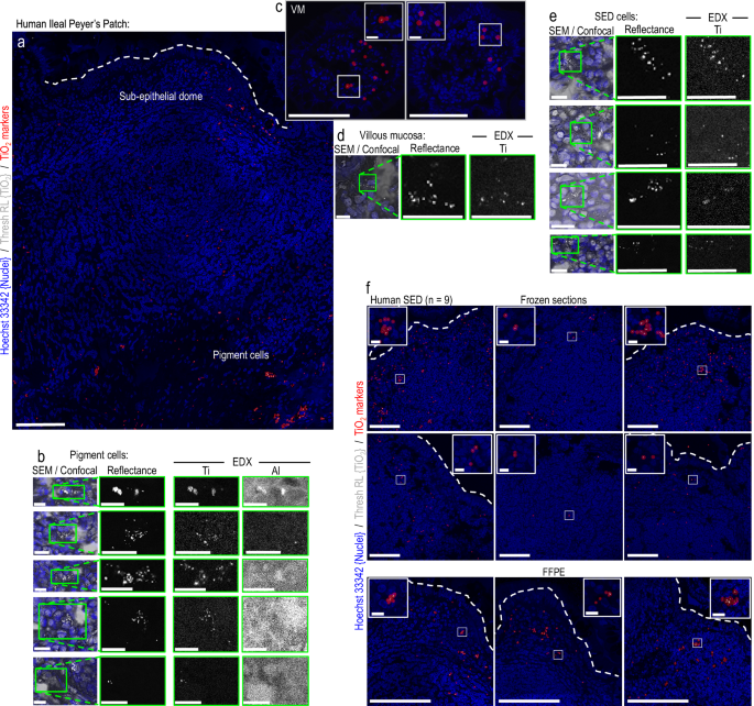 41467_2025_60248_Fig1_HTML.png